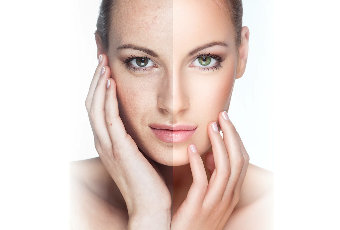 The result of the use of the cream VitalDermax is visible already after 15 minutes
