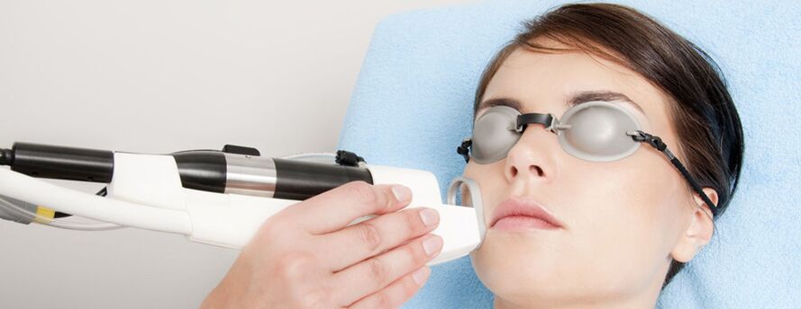 Field laser rejuvenation of the facial skin