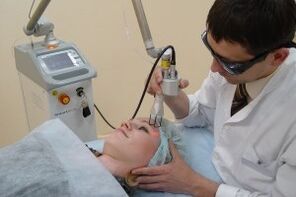 Laser facial skin rejuvenation procedure